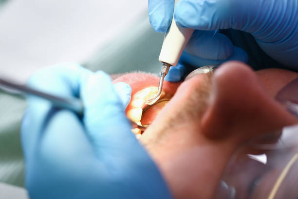 Best Chipped Tooth Repair Near Me  in Sycamore, IL