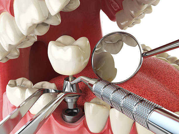 Dentist for Dental Trauma in IL
